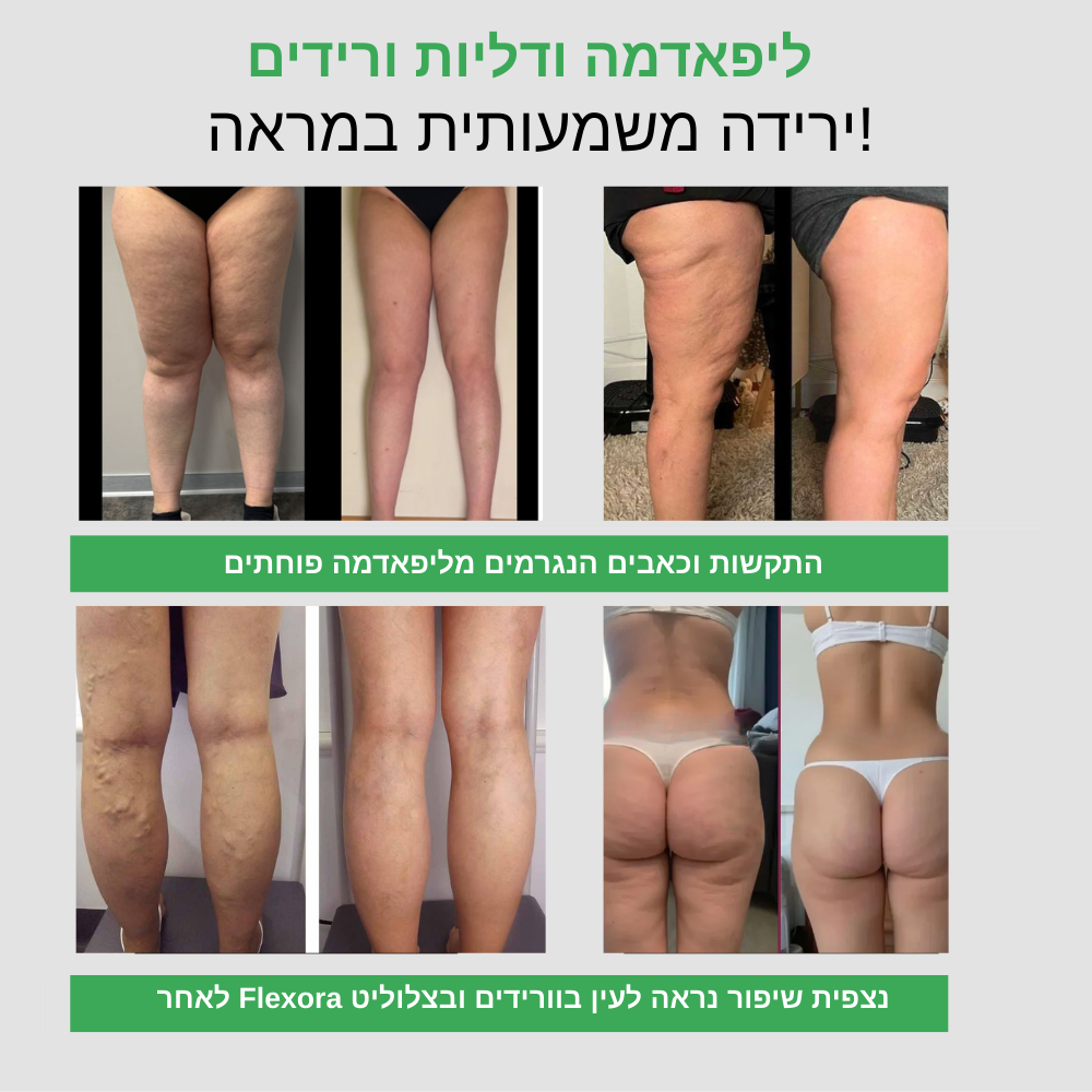 טייץ עם כיסים בעל אפקט משולש נגד צלוליט, ורידים וליפדמה FLEXORA