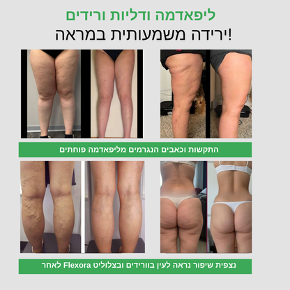 טייץ עם כיסים בעל אפקט משולש נגד צלוליט, ורידים וליפדמה FLEXORA